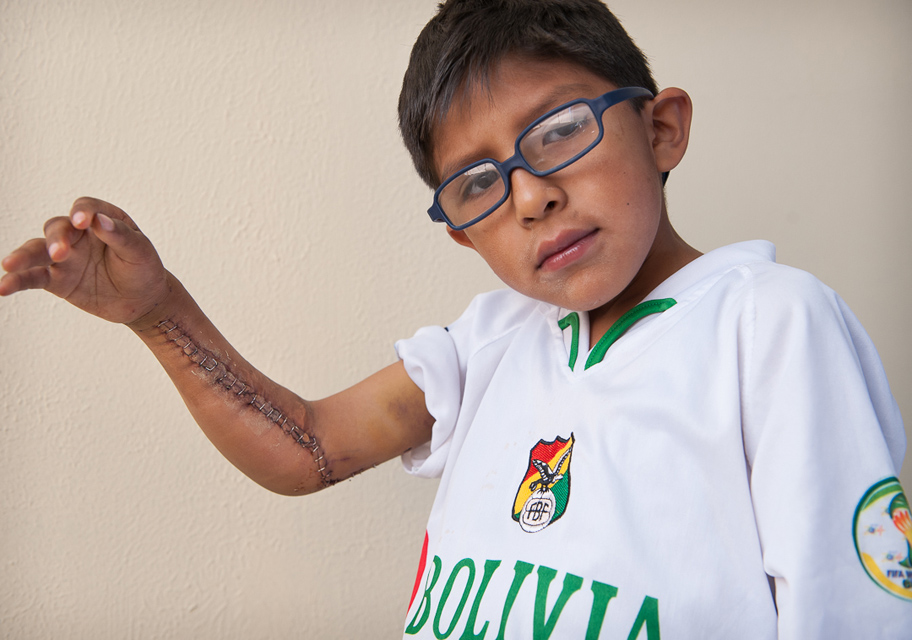 ZANE WILLIAMS photographer ReSurge in Bolivia